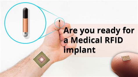 micro rfid chips|chip for human identification.